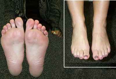 Kristi's Feet